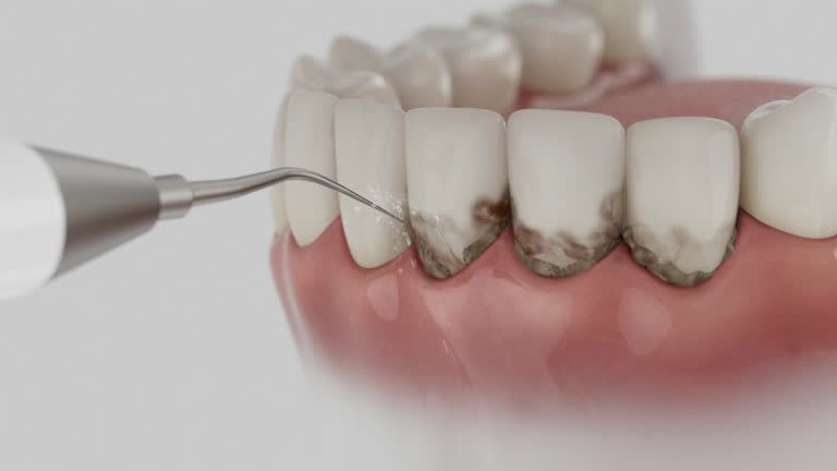 Reliable Dental contractor in Potosi, TX by Dentist Open Now